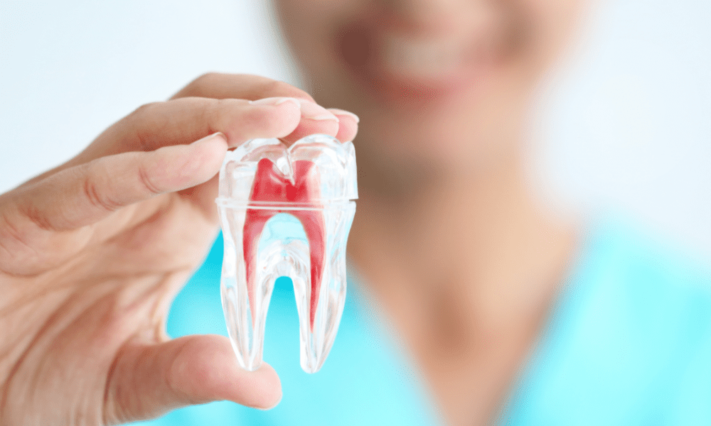 درمان عصب کشی دندان یا ریشه