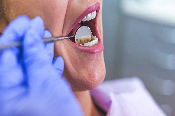 درمان برای عفونت دندان